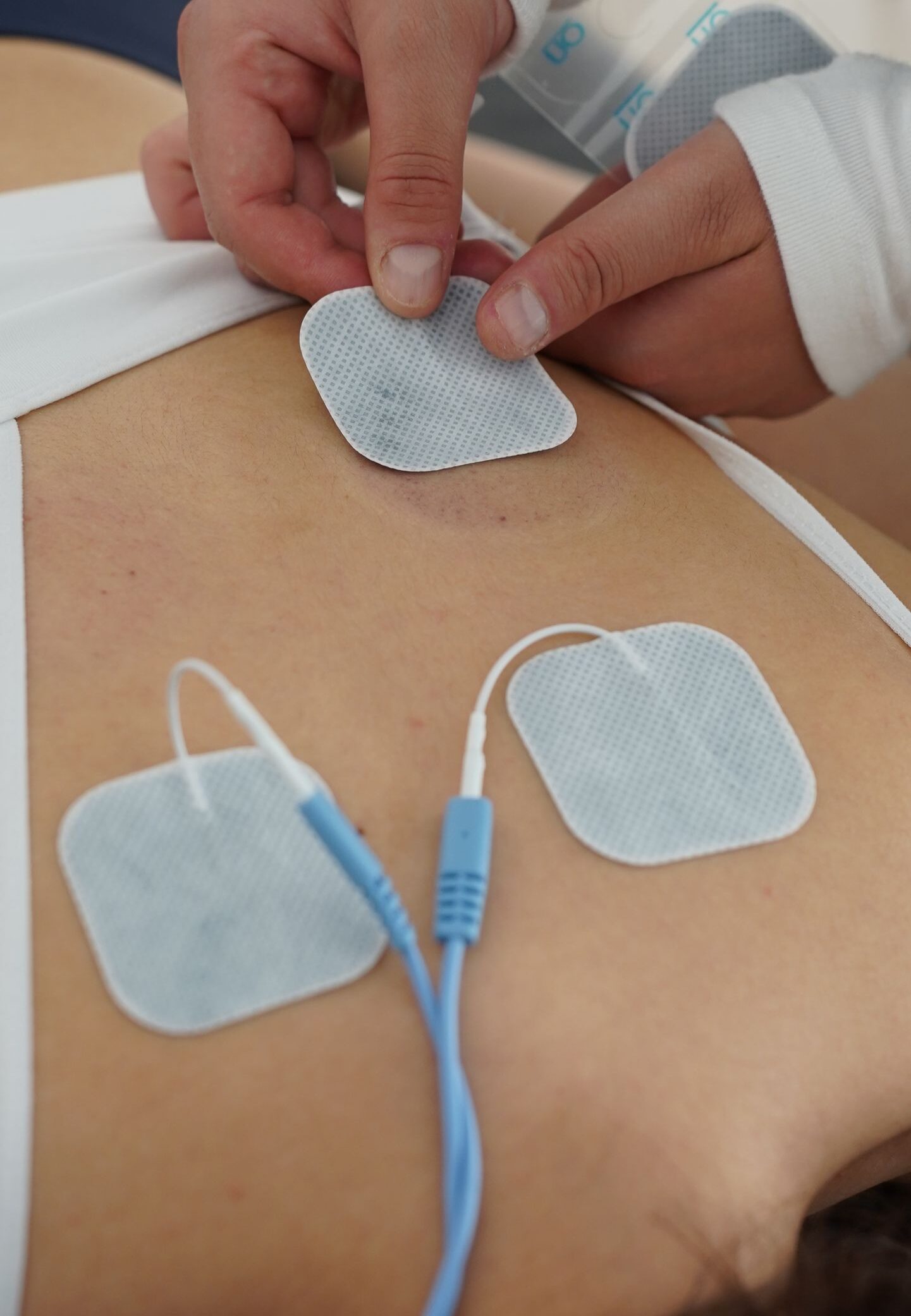 Hands applying electrotherapy pads on the back for muscle stimulation.